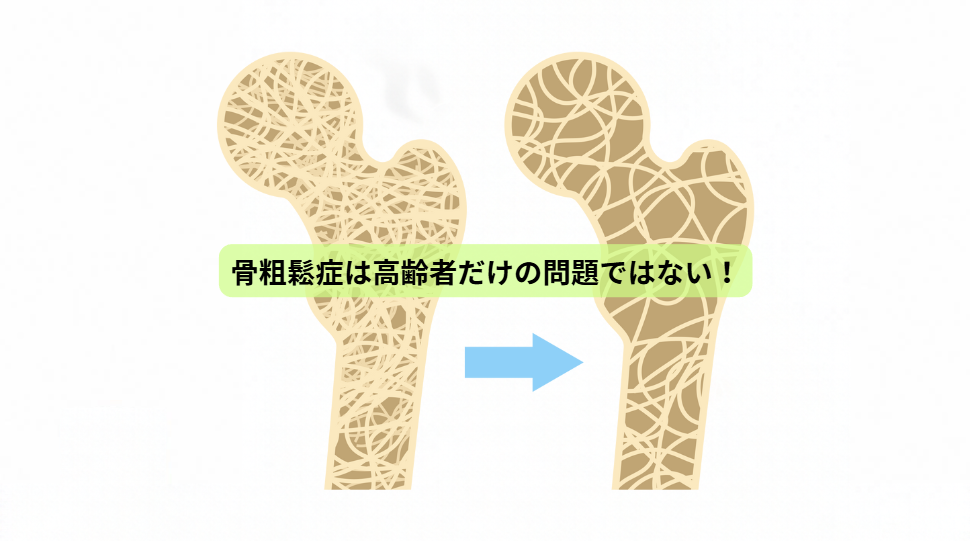 骨から始める健康寿命の延ばし方【第１回】骨粗鬆症は高齢者だけの問題ではない！