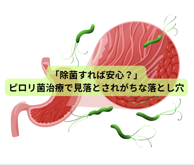 ピロリ菌のはなし【第5回】「除菌すれば安心？」──ピロリ菌治療で見落とされがちな落とし穴